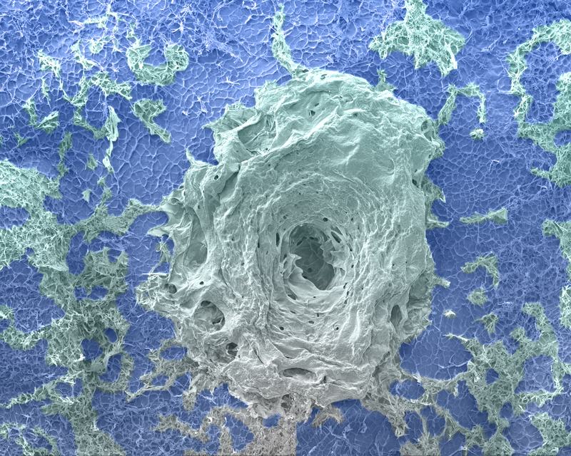 False-colored scanning electron microscope image of a tissue engineering scaffold. A pale green, swirled, crater-like structure sits in the center of a blue porous surface.